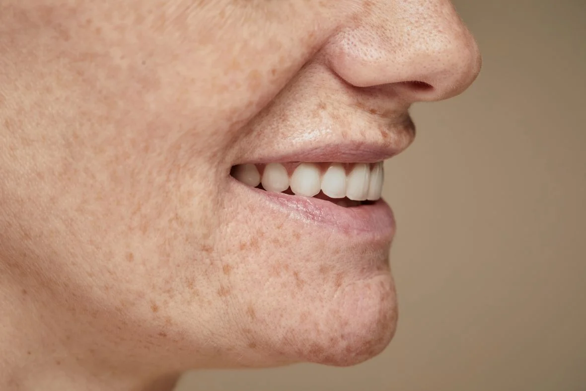 Dentadura postiza a presión