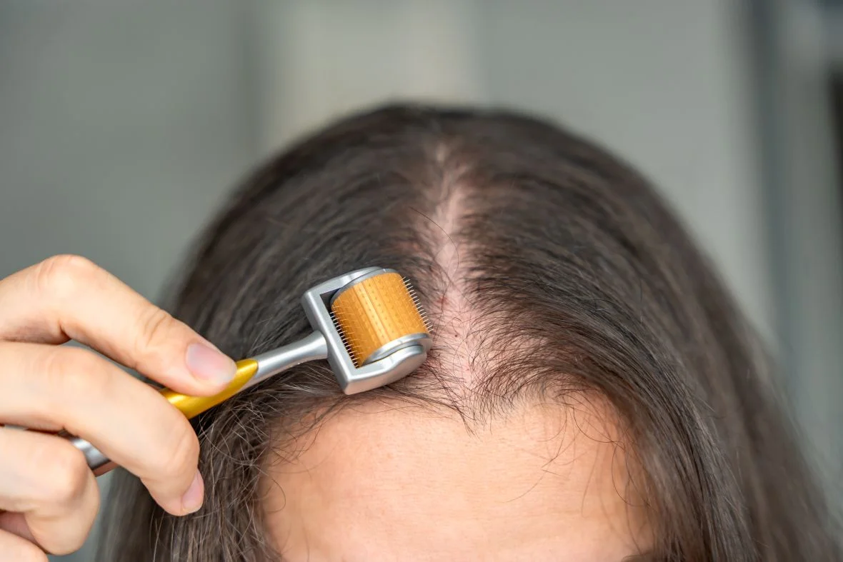 ¿Cuáles son los tratamientos auxiliares que se pueden aplicar en casa para retrasar la caída del cabello?