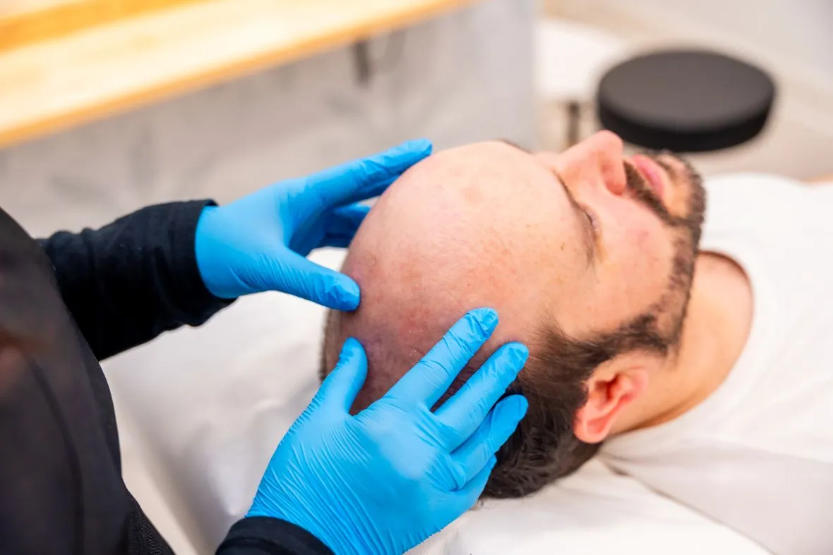 Hair Transplant in Turkey with Oktay Tüney Clinic: Natural Results, Transparent Costs, Advanced FUE